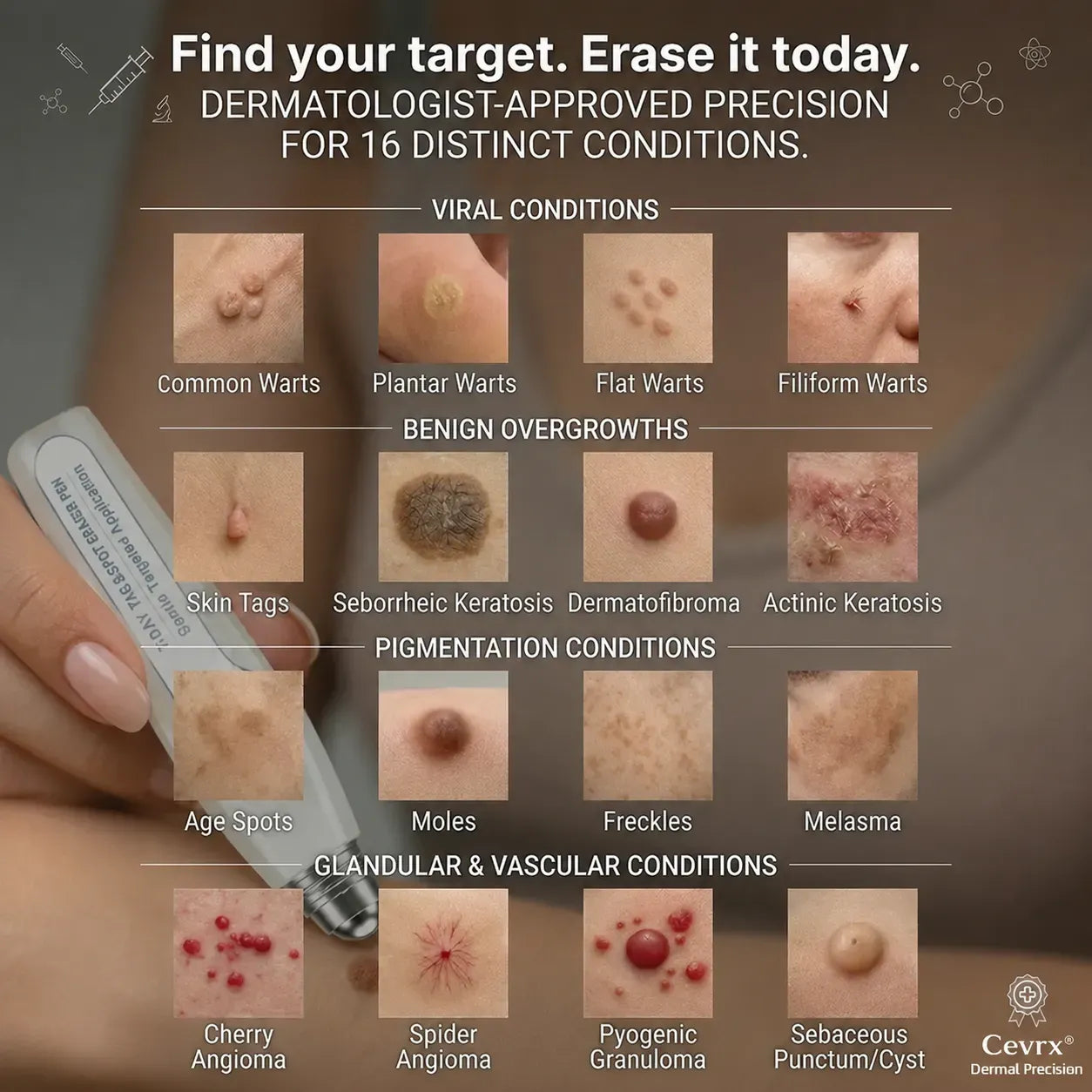 SILVLYA™ Precision Skin Tag Care Roll-On – Targeted Botanical Care