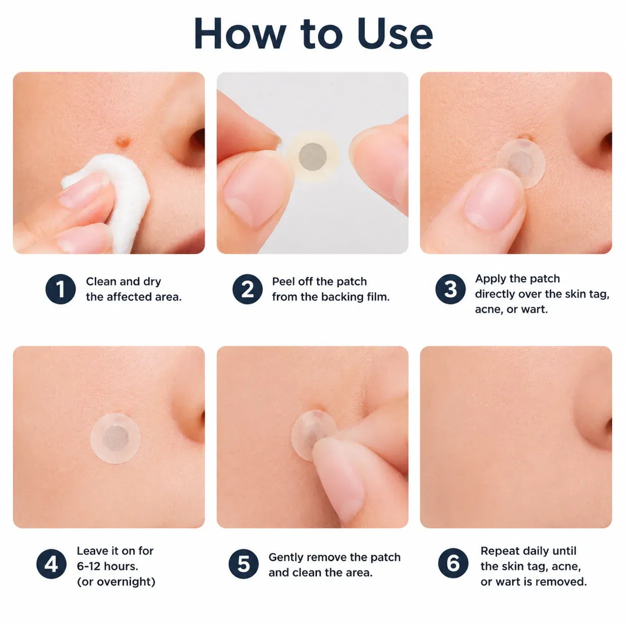 ✨2-in-1 Microneedle & Hydrocolloid Patch🍀| Removes Raised Moles, Acne, Flat Warts & Skin Tags | Helps Improve Wrinkles, Scars & Blemishes | Invisible Patches for Face & Body
