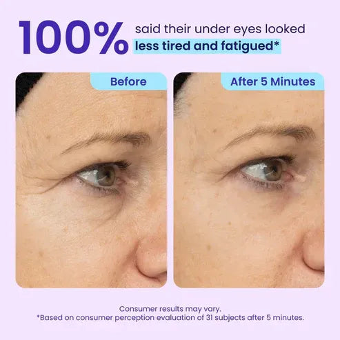 SILVLYA® Instant Eye Lift Gel – Your 5-Minute Morning Eye Refresh