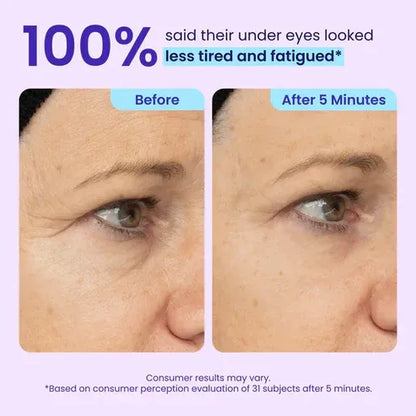 SILVLYA® Instant Eye Lift Gel – Your 5-Minute Morning Eye Refresh