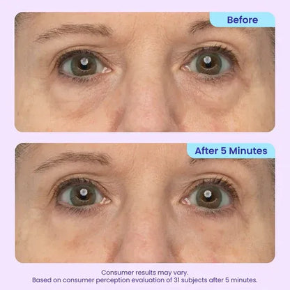 SILVLYA® Instant Eye Lift Gel – Your 5-Minute Morning Eye Refresh