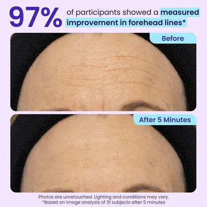 SILVLYA® Instant Eye Lift Gel – Your 5-Minute Morning Eye Refresh