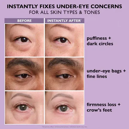SILVLYA® Instant Eye Lift Gel – Your 5-Minute Morning Eye Refresh